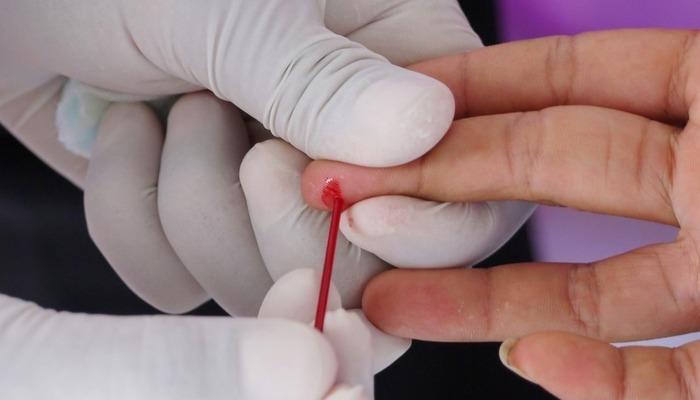 Uzman açıkladı: Türkiye nüfusunun yüzde 2,1'i taşıyıcı!  Bu bölgede daha sık görülüyor