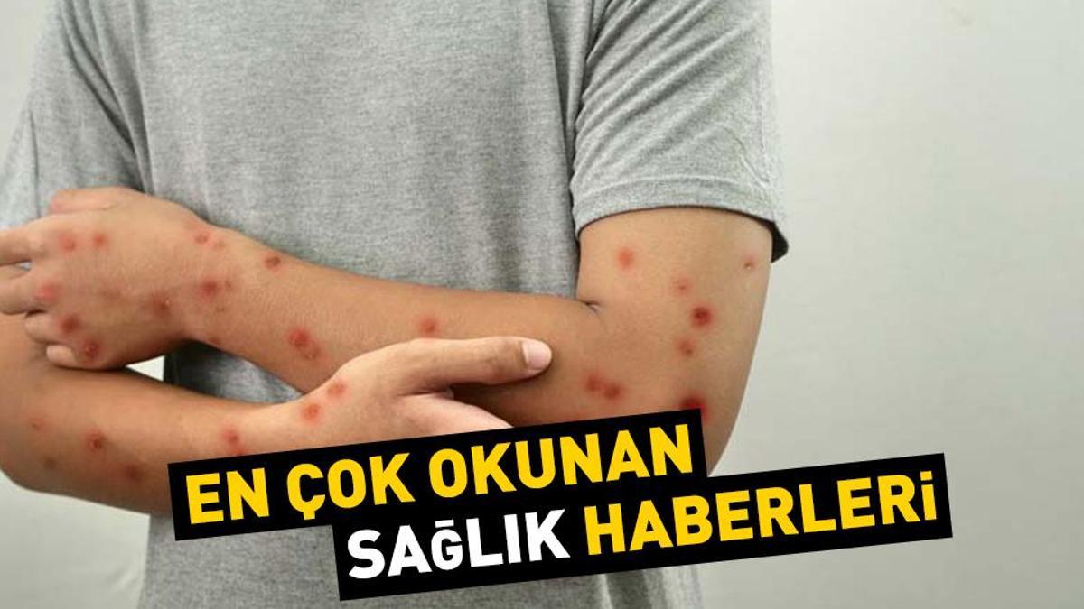 Günün en önemli sağlık haberleri, 21 Ağustos 2024...