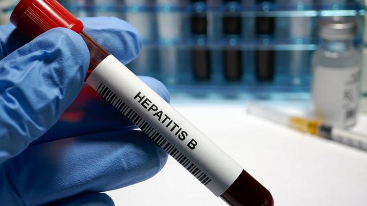 Hepatit B Belirtileri Nelerdir? Hepatit B Nasıl Anlaşılır? Tedavi Yöntemleri Nelerdir?